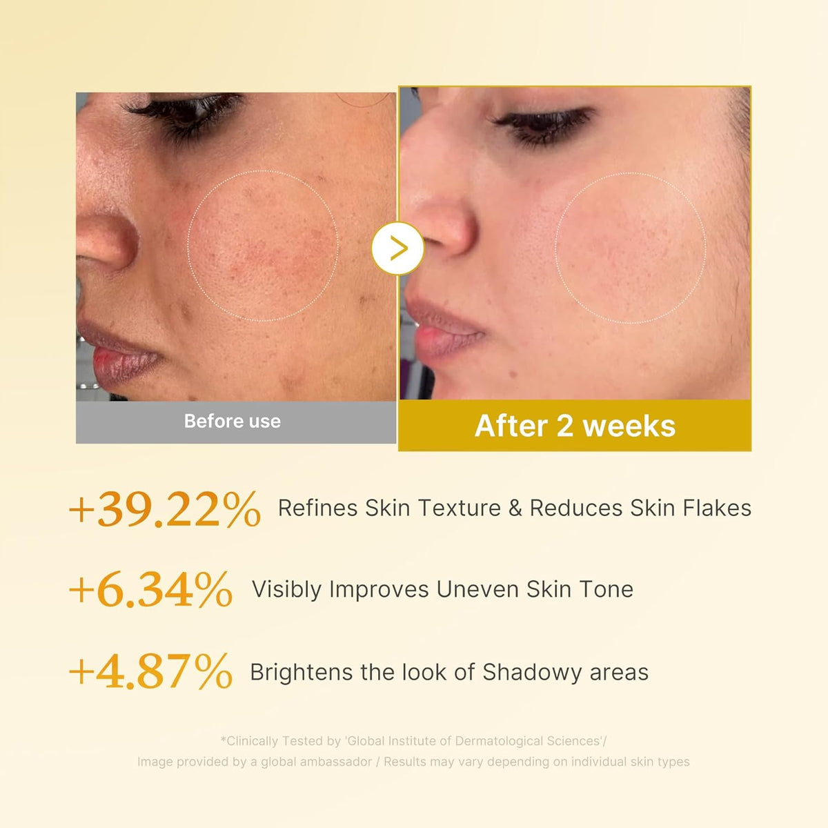 Kojic Acid Turmeric Resurfacing Toner 250mL