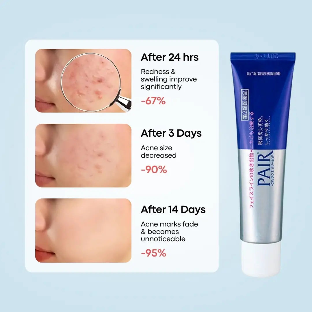 Lion Pair Acne Cream 24g