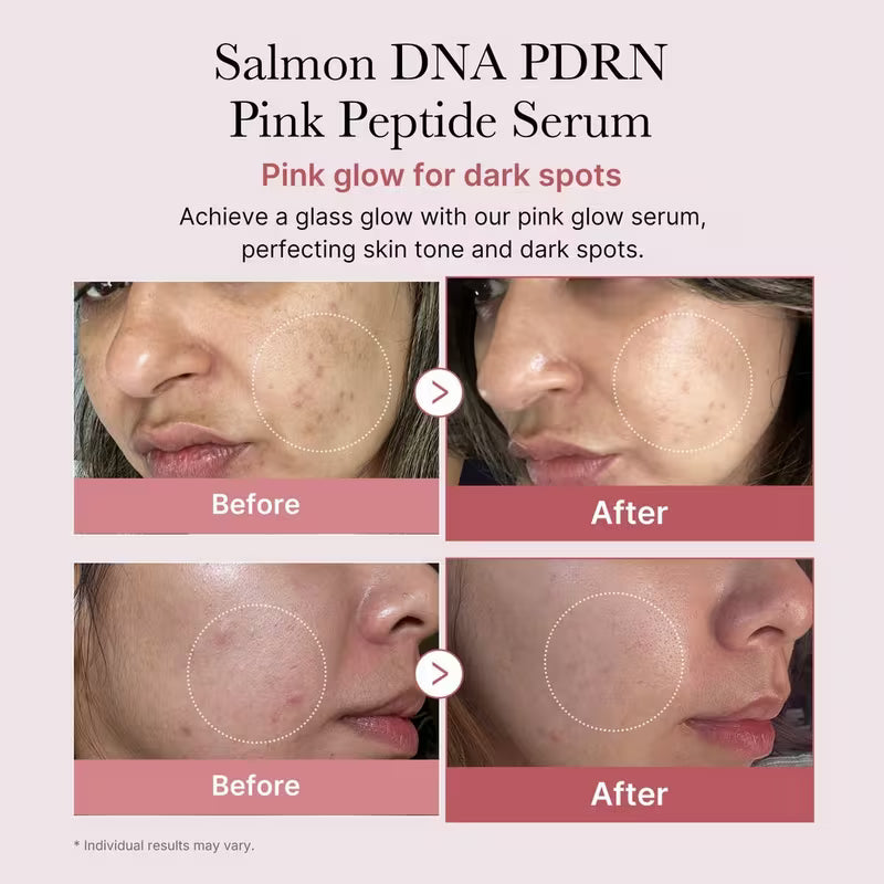 Salmon PDRN Pink Peptide Serum
