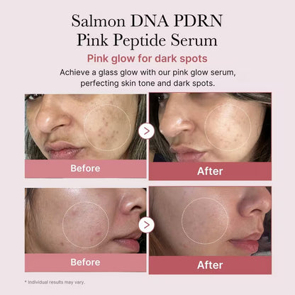 Salmon PDRN Pink Peptide Serum