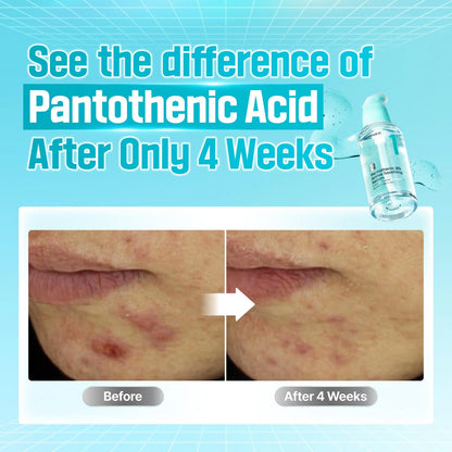 No.1 Pantothenic B5 Active Soothing Serum 50ml