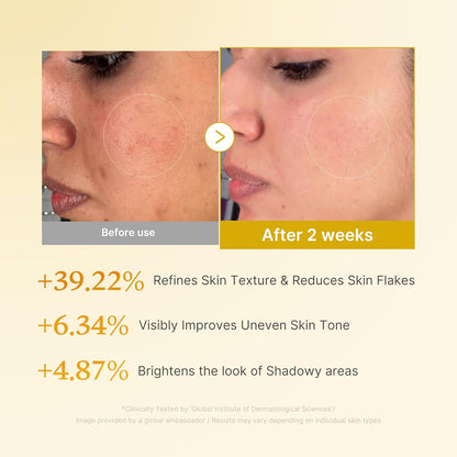 Kojic Acid Turmeric Resurfacing Toner 250mL