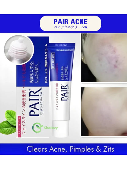 Lion Pair Acne Cream 24g