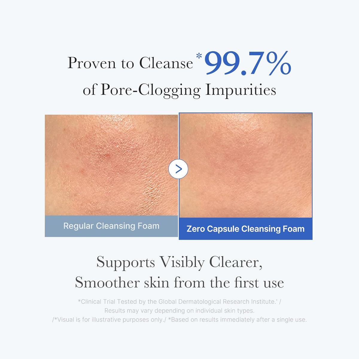 Zero Pore Clearing Capsule Cleansing Foam 120g
