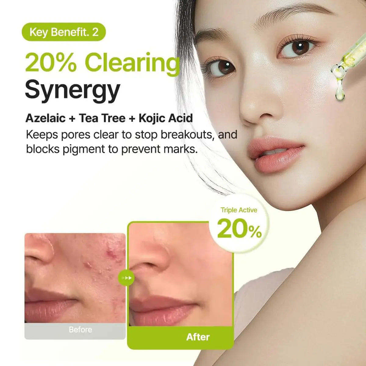 Azelaic Acid 10 Kojic Tea Tree Serum 30ml