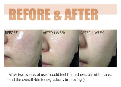 No.5 Goodbye Blemish Serum 50ml