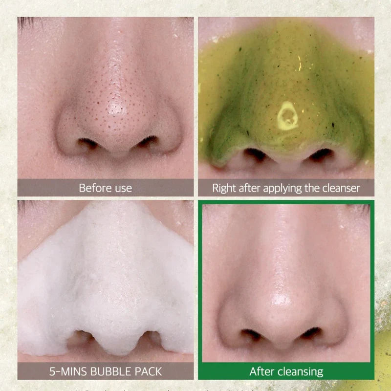 Bye Bye Blackhead 30 Days Miracle Green Tea Tox Bubble Cleanser 120g