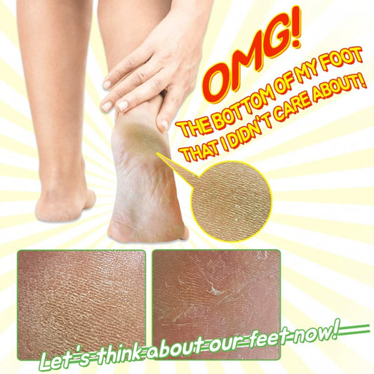 Witch Piggy Hell Pore Turtle Foot Pack (1pair)