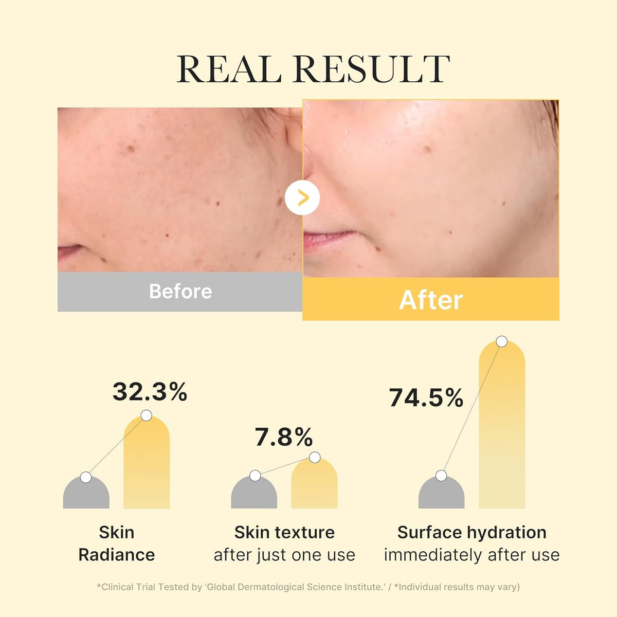 Kojic Acid Turmeric Brightening Gel Mask [4ea]